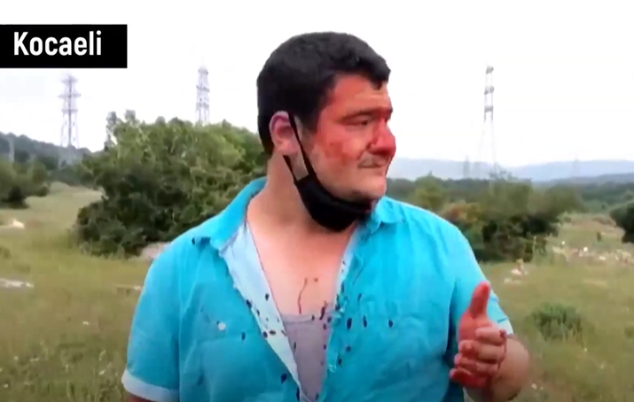 Türkiyeli gazeteci Kocaeli’de darp edildi, ekipmanları kırıldı